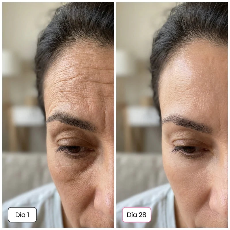 Reduce las arrugas con DragonLift® en 7 días / 1+1 GRATIS