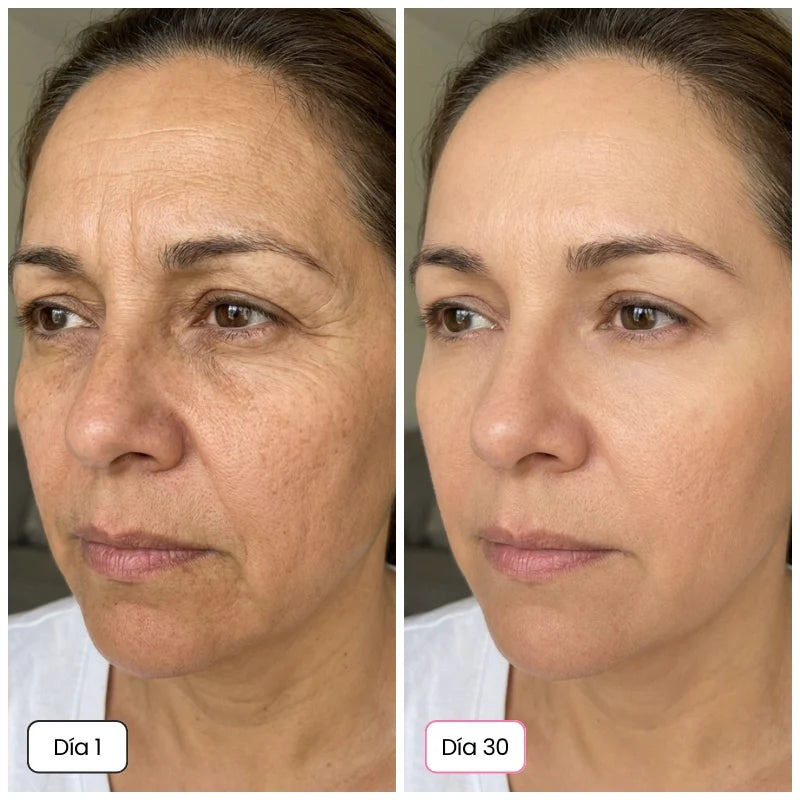 Reduce las arrugas con DragonLift® en 7 días / 1+1 GRATIS